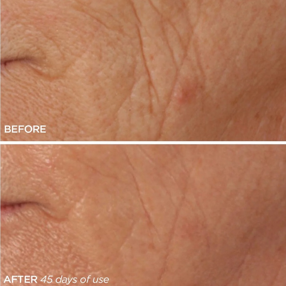 BeautyBio R45 Retinol Booster Set - Rose Gold - Picture 5 of 6